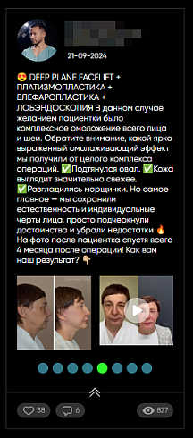 Посты из ВК | VK | Вконтакте на своем сайте